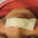 Jak pogonić pryszcza